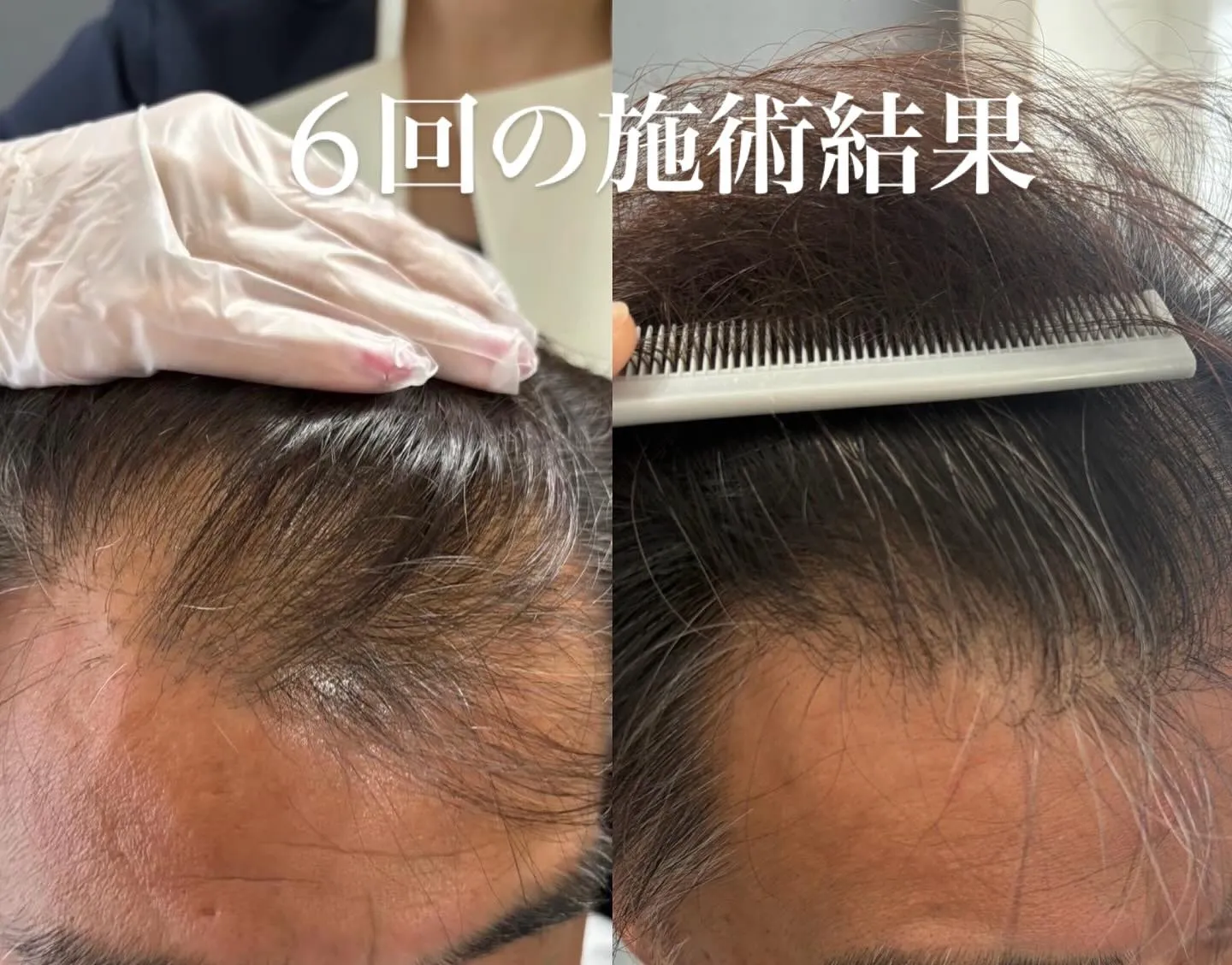 これまで数々の育毛ケアを試しても、思うような結果が出なかった...