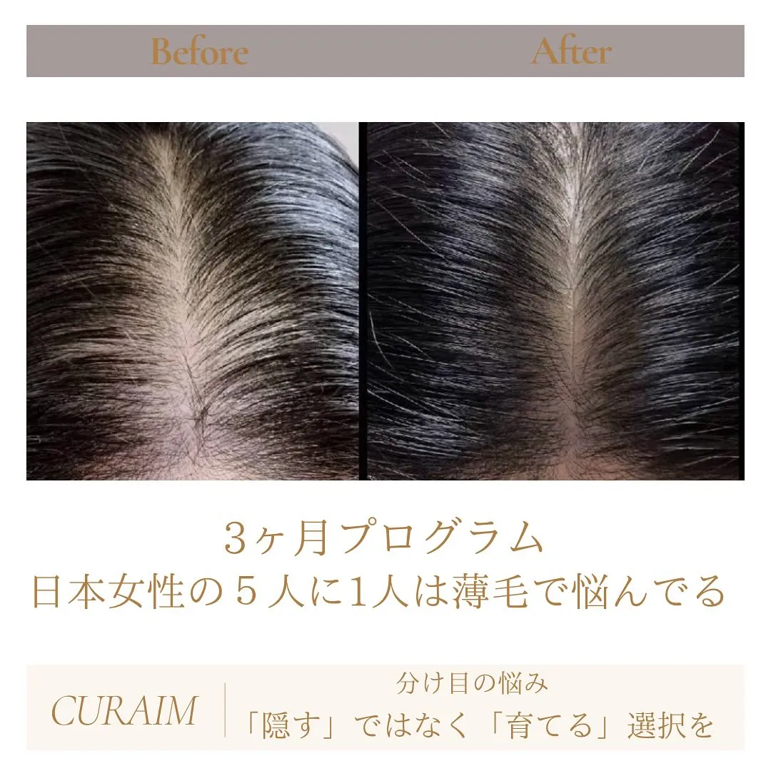 📸【“分け目が薄くなった気がする…” それ、髪からのSOSか...