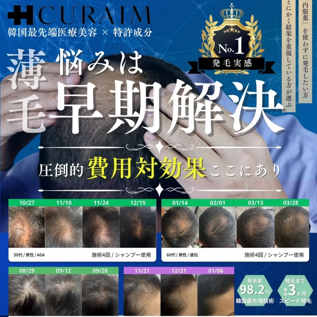 薄毛の悩みは、