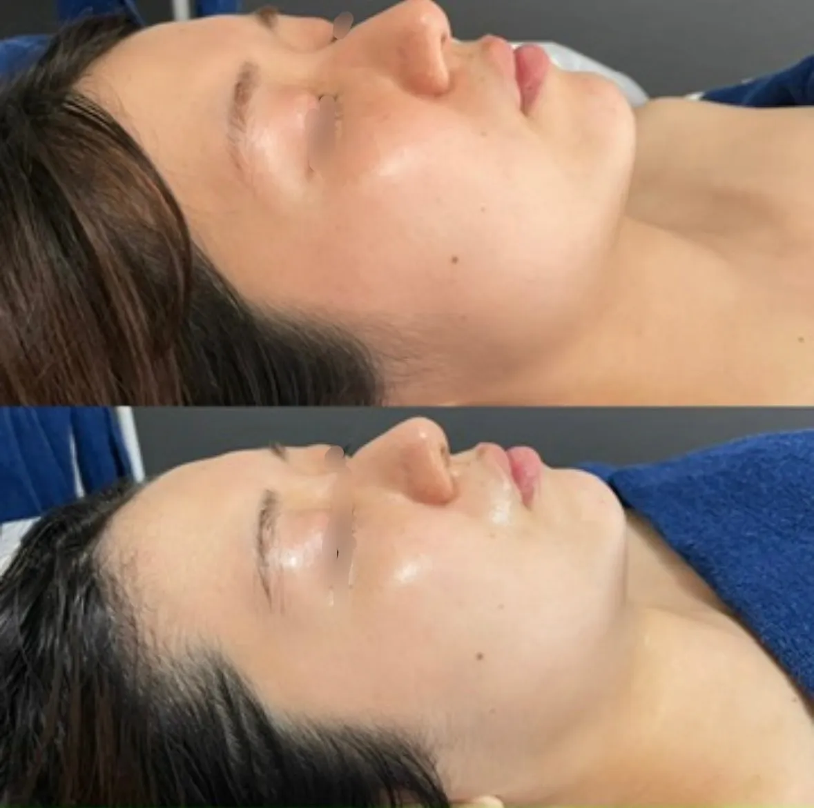 陶肌トリートメント