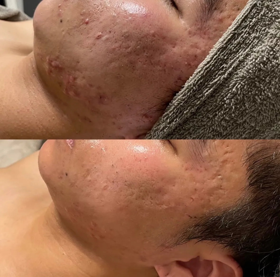 陶肌トリートメント