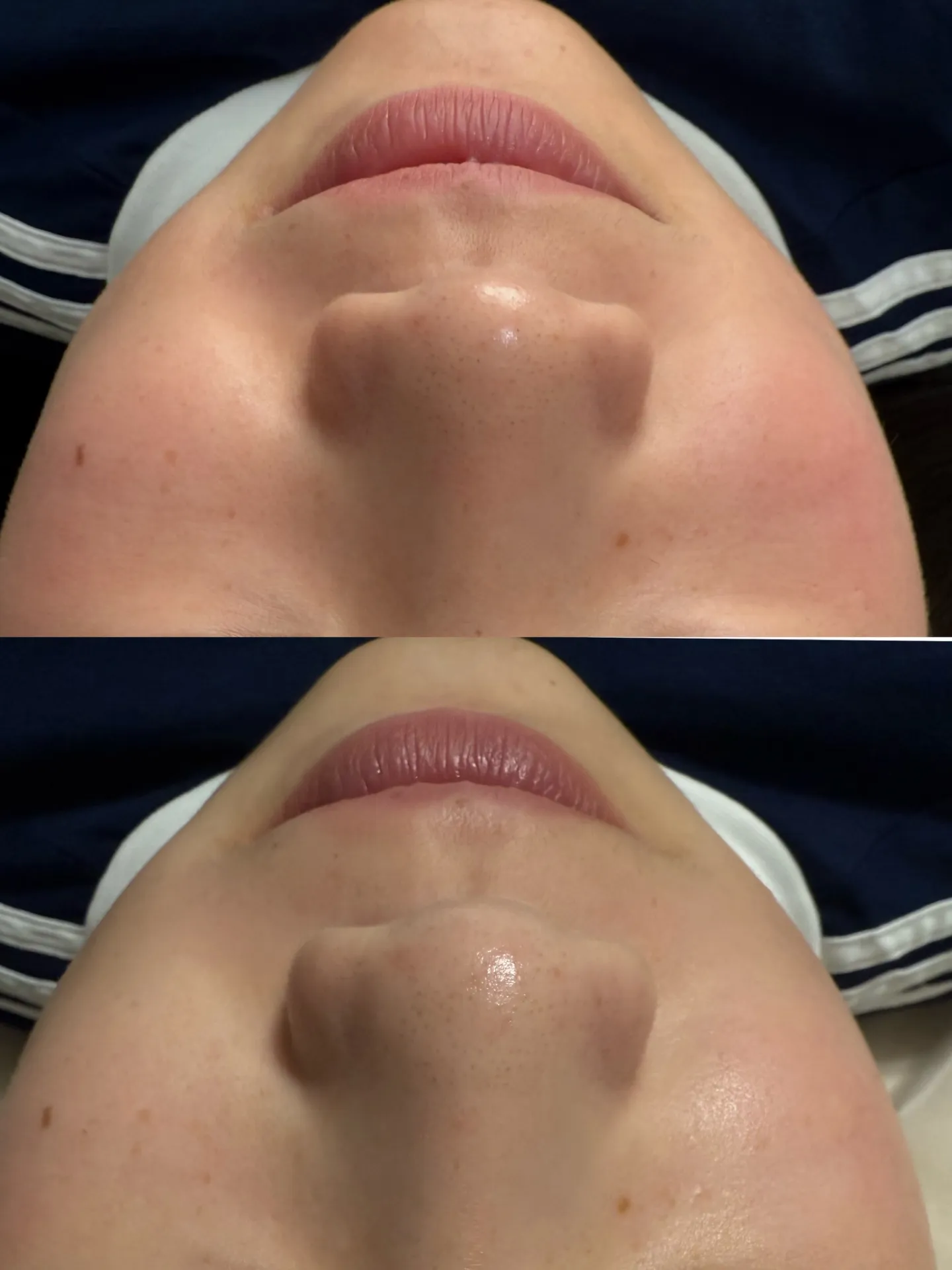 ハイドロスプラッシュ