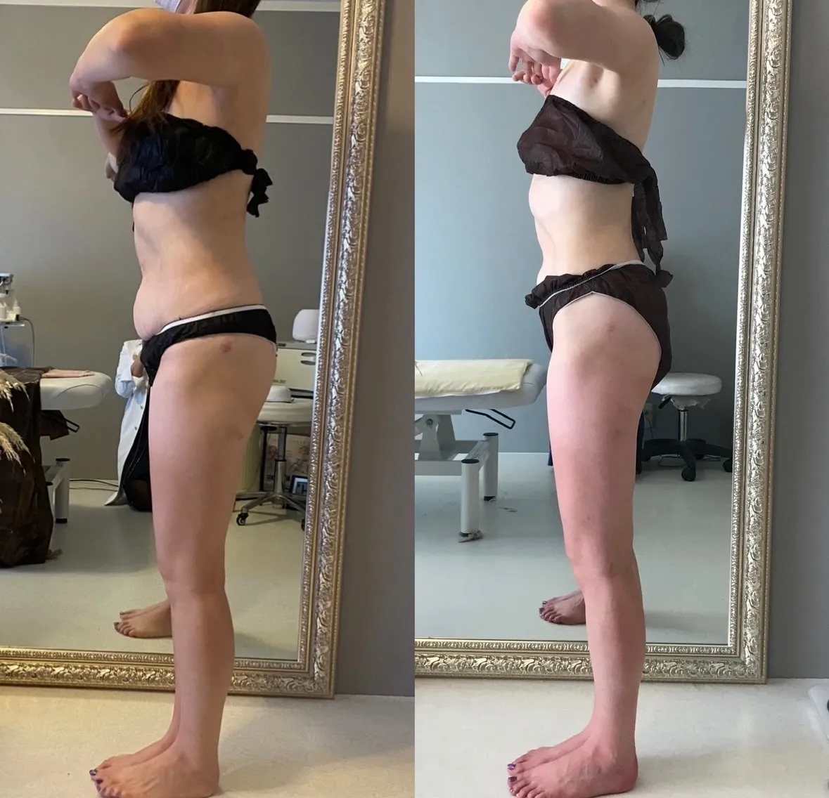 ダイエットスクール（美BODY版）