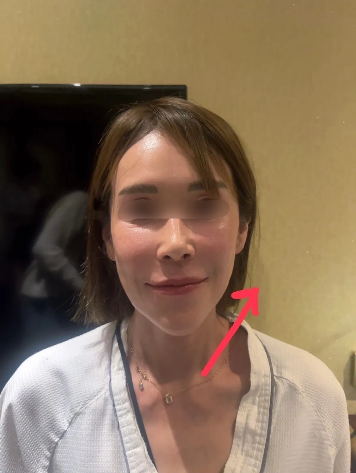 フィジオショット