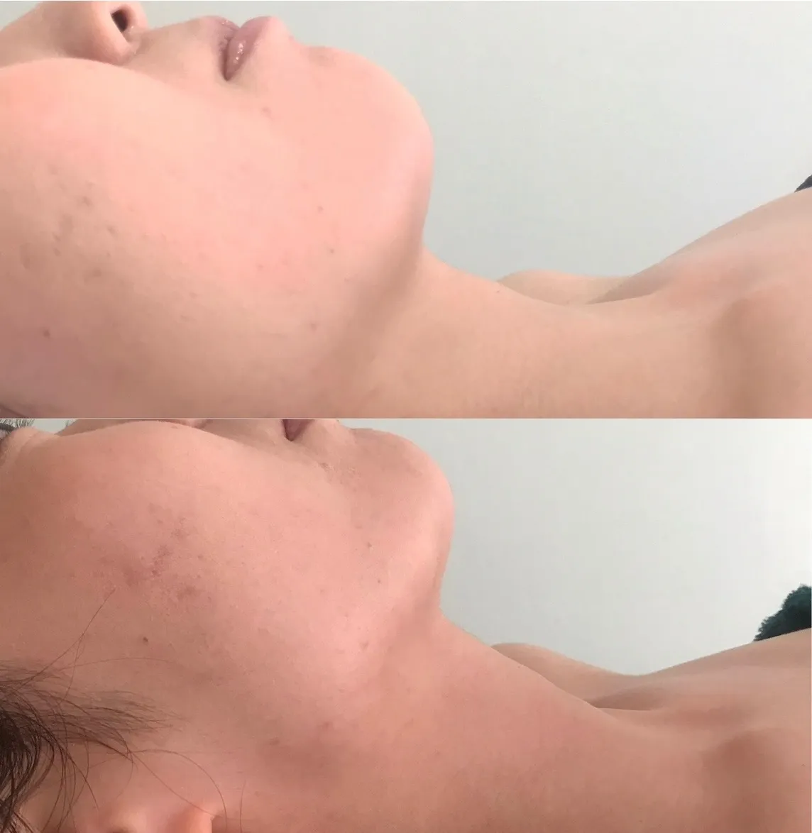 フィジオショット（子顔）