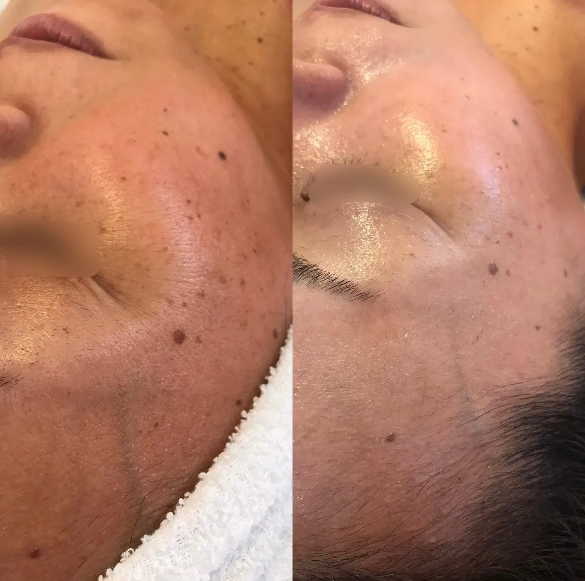 CURAIM美肌（目元のシワ、くすみ改善）