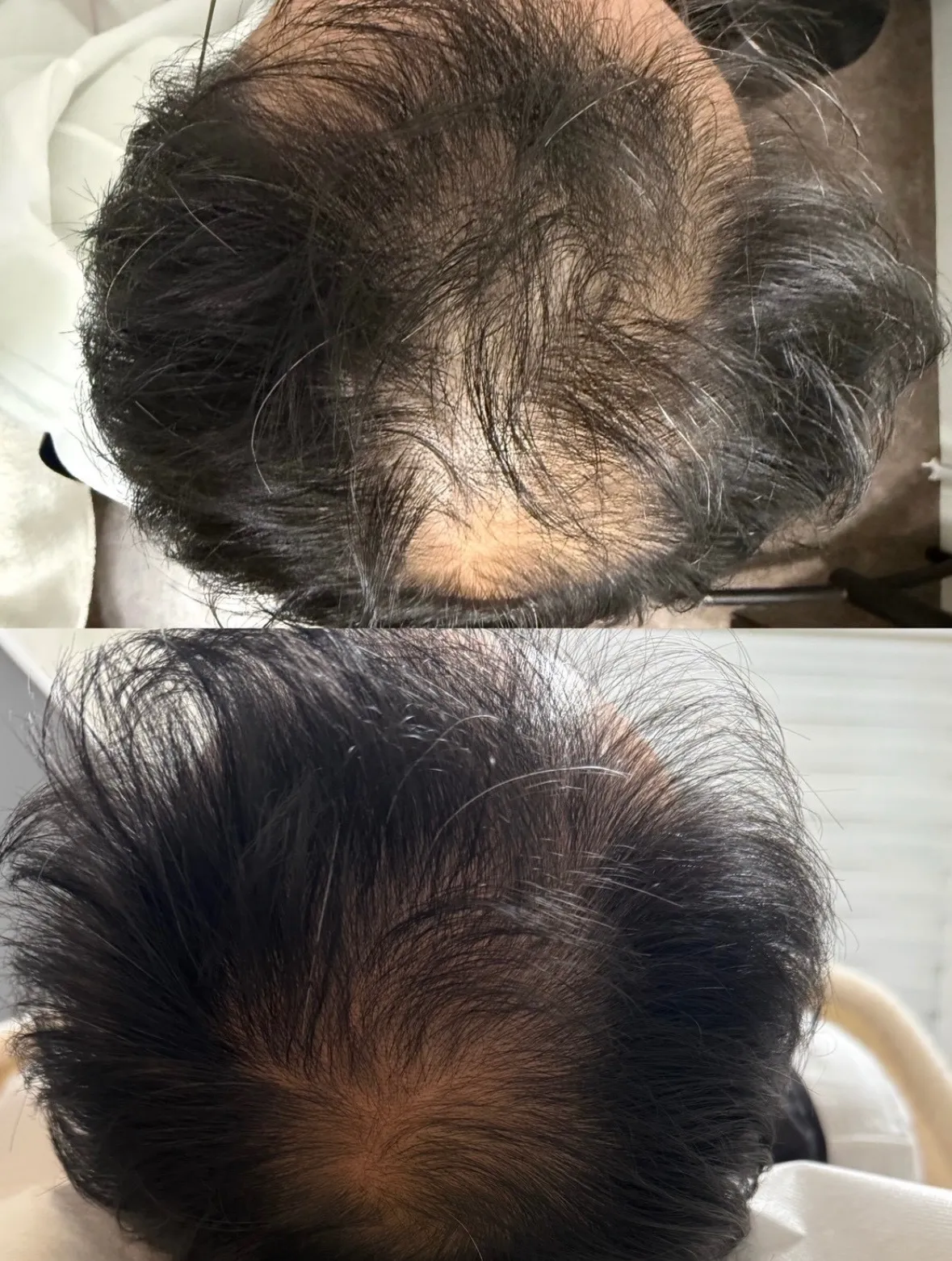 最先端本格育毛