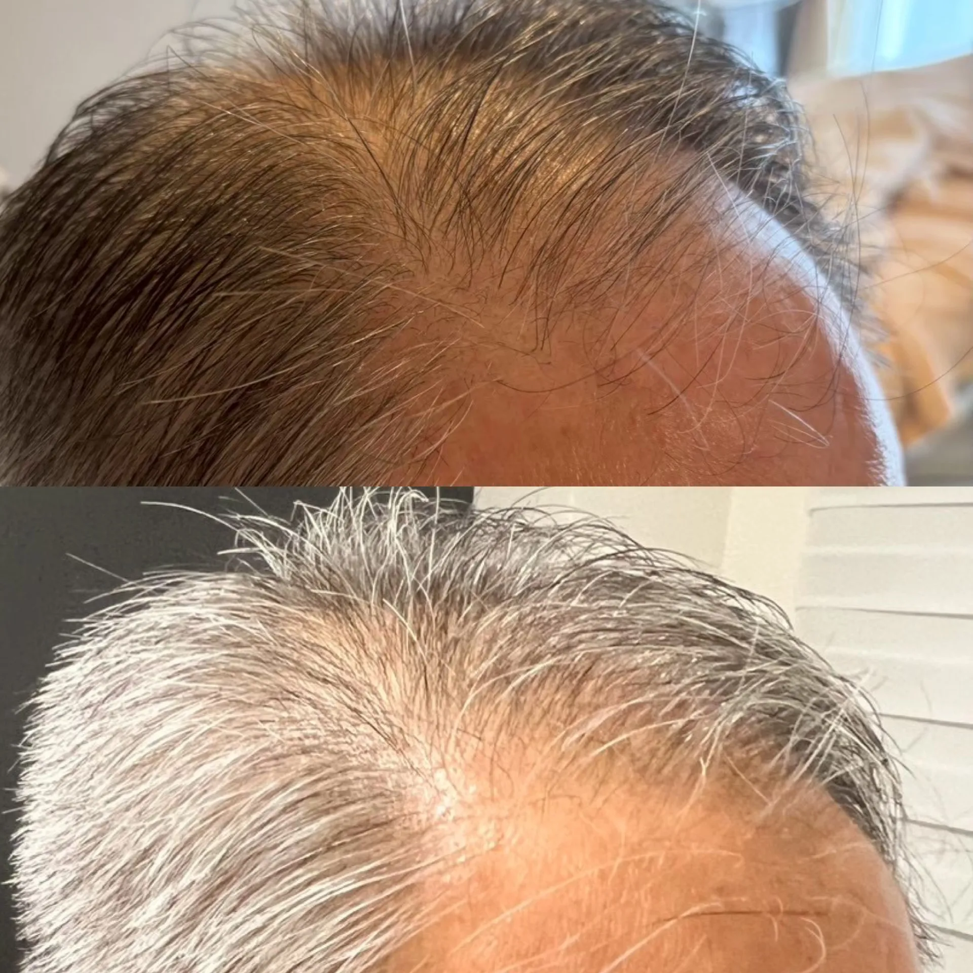 最先端本格育毛