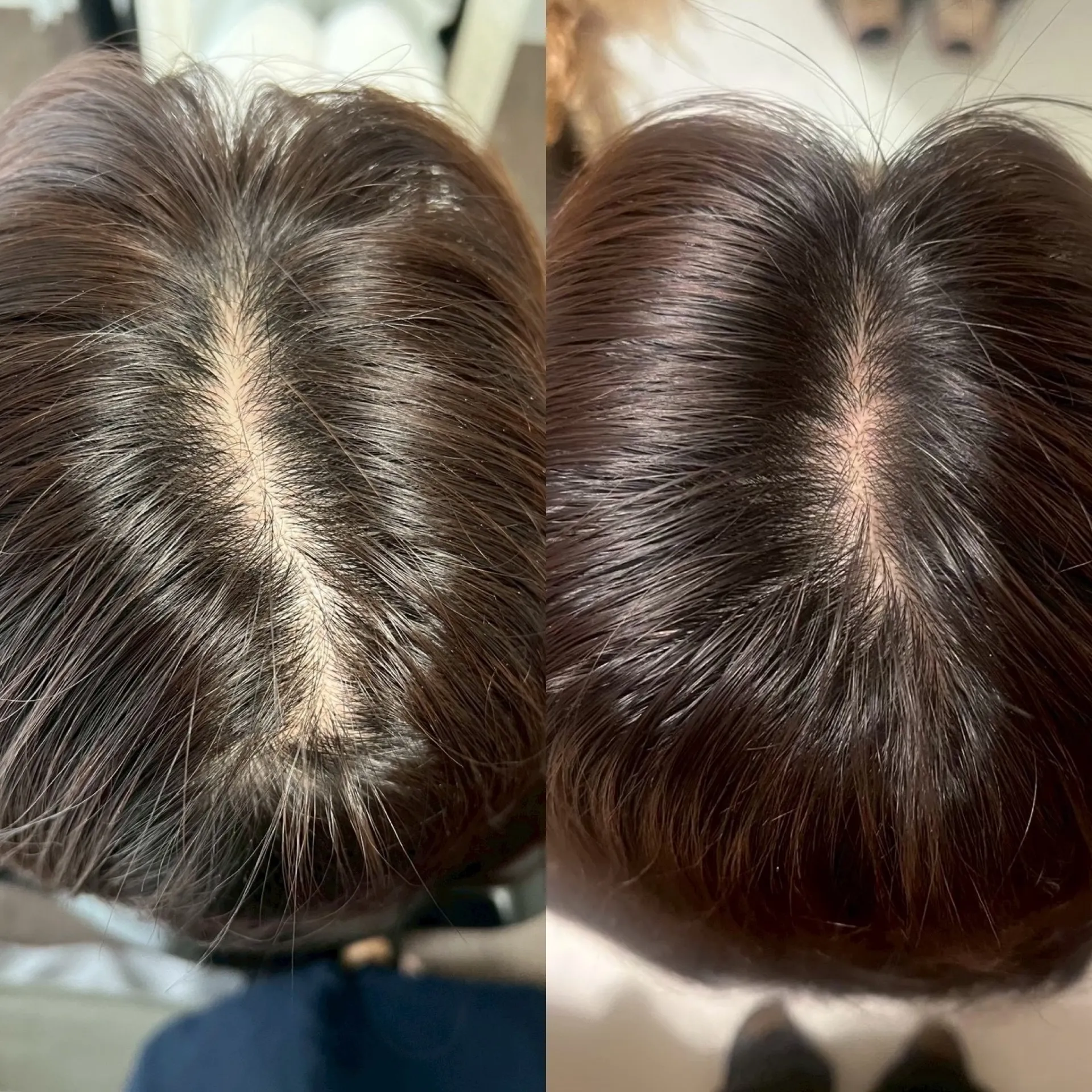 最先端本格育毛