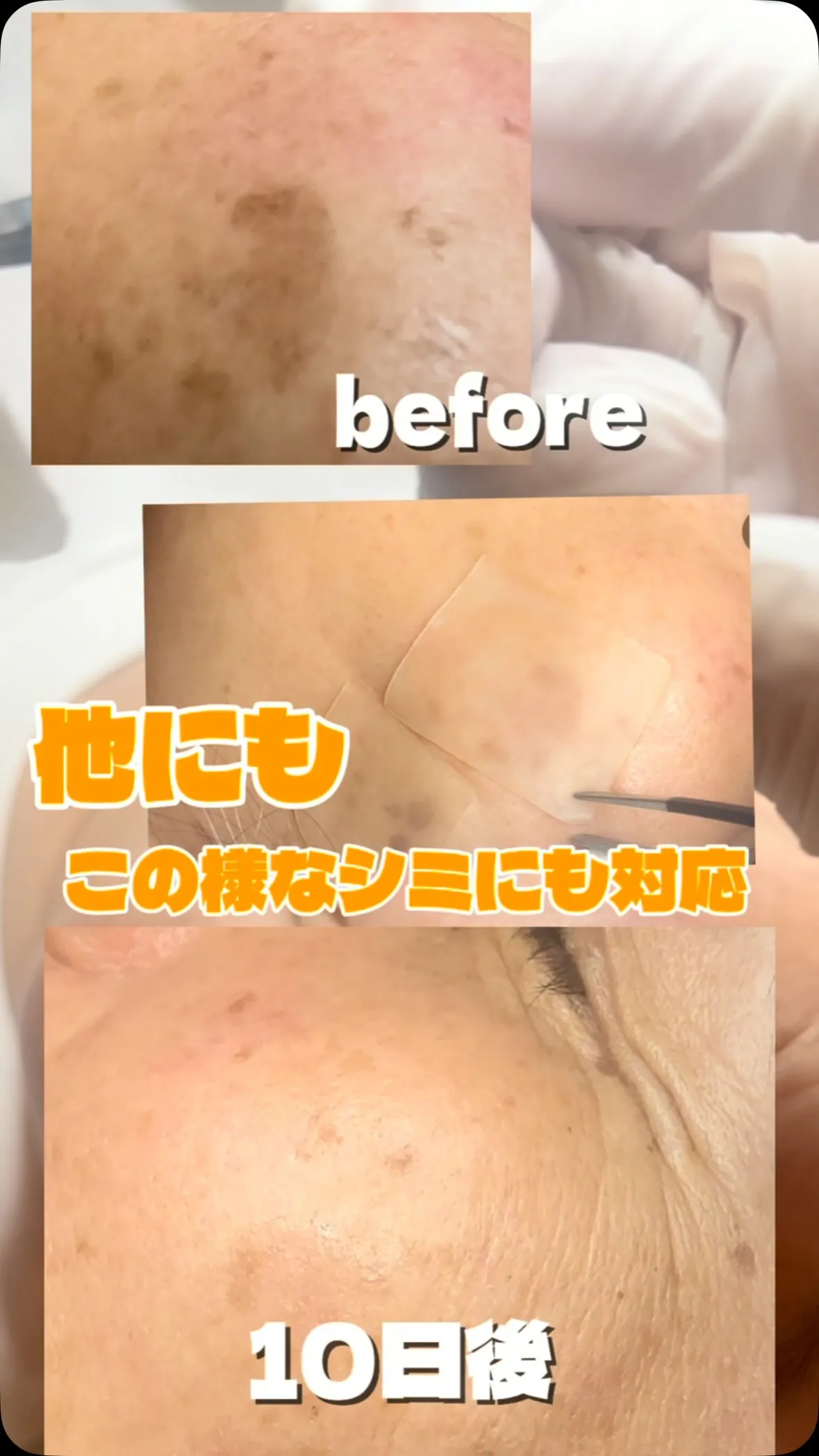 「そのシミ、隠し続けますか？」